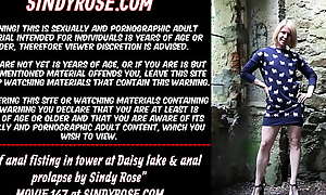Self anal fisting in tower at Daisy lake and anal prolapse by Sindy Rose