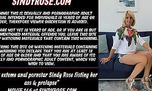 Sexy exteme anal pornstar Sindy Rose fisting her ass and prolapse