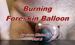 Foreskin balloon for slave Winkelhock Part2