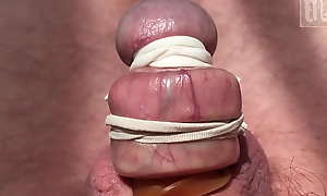 Stretched foreskin and tied glands,